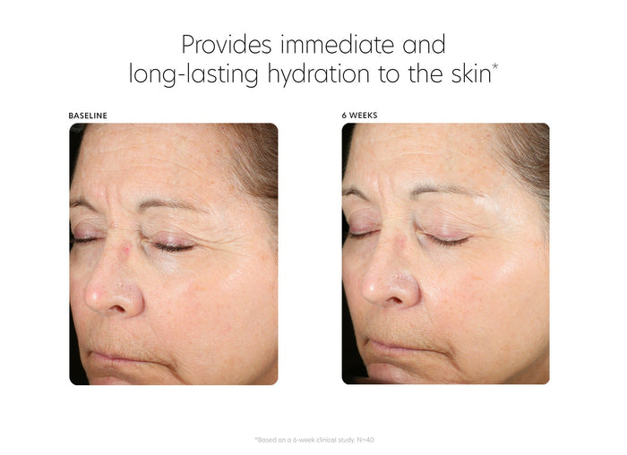 Before and after comparison of an older woman's face showing improved skin hydration and reduced dryness after six weeks using Hyaluronic Acid Boosting Serum | PCA Skin.